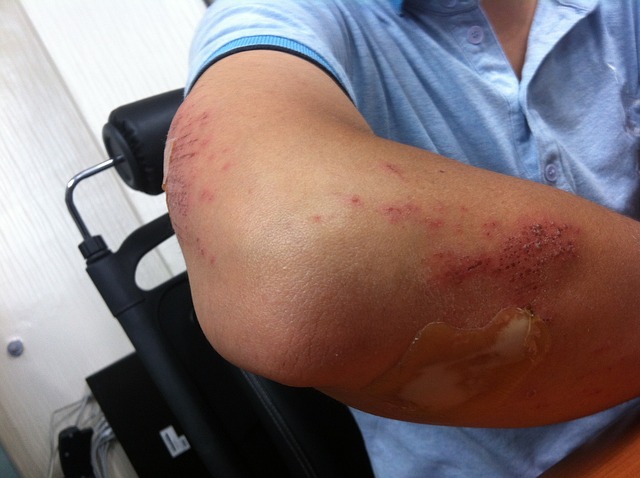 Understand Arizona Personal Injury Laws